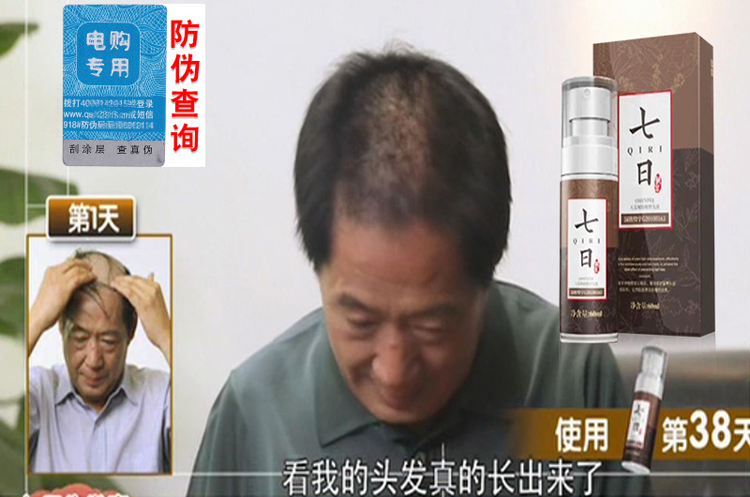 用"七日生发素"让您告别头发稀疏,脱发,掉发的烦恼!
